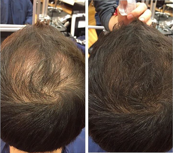 Before and after hair fibers