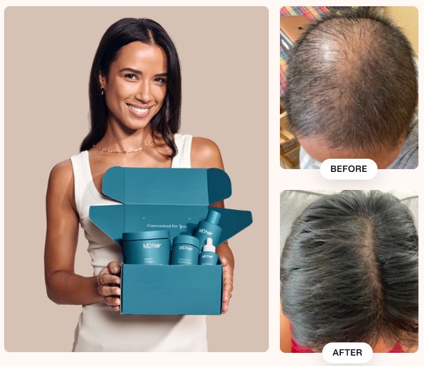 MDhair - Effective Hair Regrowth Tailored to You